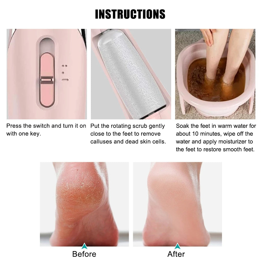 Electric Feet Callus Remover