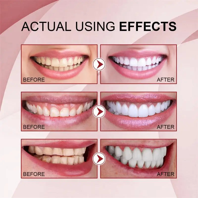 SP-6 Ultra Whitening Toothpaste